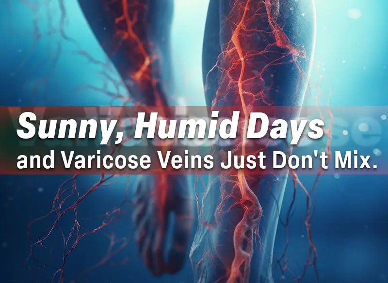 Sunny Humid Days and Varicose Veins